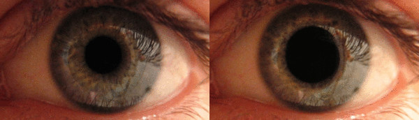 Pupil-size-comparison