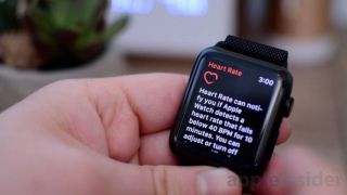 Лікарі стурбовані: Apple Watch відправляють здорових користувачів на перевірку серця